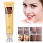 ACNE SCAR REMOVAL CREAM