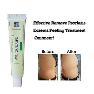 ADVANCED PSORIASIS & ECZEMA CREAM