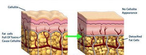 Cellulite Removal Cream